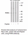 Product image for PAR4 Antibody