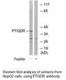 Product image for PTGDR Antibody