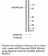 Product image for Aggrecan (Cleaved-Asp369) Antibody