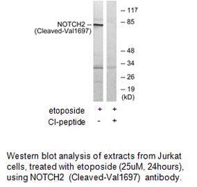 Product image for NOTCH2 (Cleaved-Val1697) Antibody