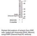Product image for PARP (Cleaved-Asp214) Antibody