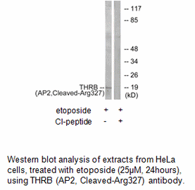 Product image for THRB (AP2,Cleaved-Arg327) Antibody