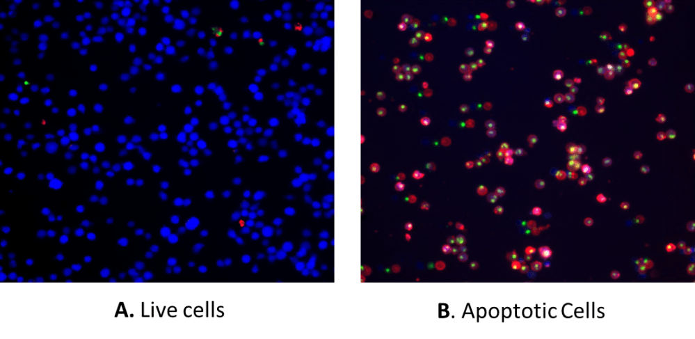 Non-induced control cells and Triple staining of staurosporine-induced cells.