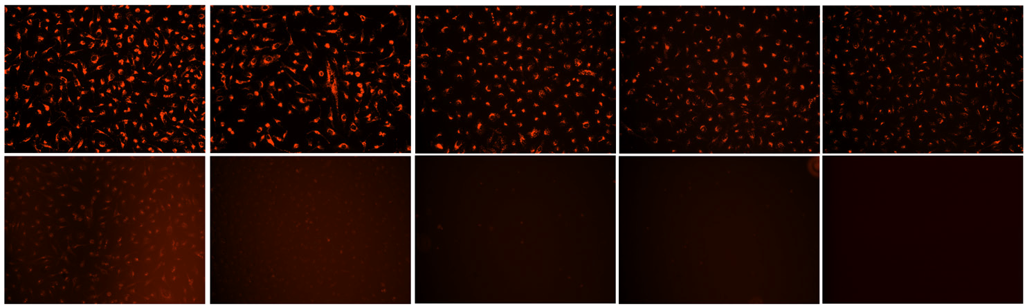 Hela cells stained with Cell Navigator Lysosome Staining Kit and LysoTracker Red DND-99