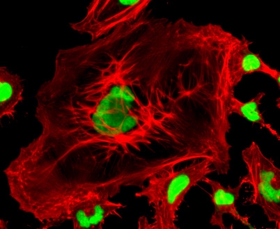 Image of HeLa cells