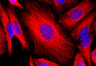 HeLa cells were stained with mouse anti-tubulin.