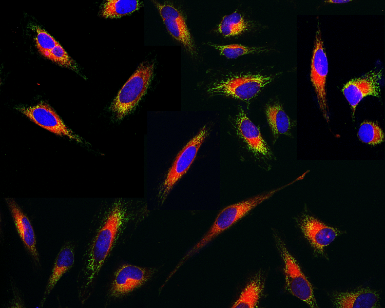 Live cells stained with Cell Navigator<sup>®</sup> Live Cell Endoplasmic Reticulum Staining Kit