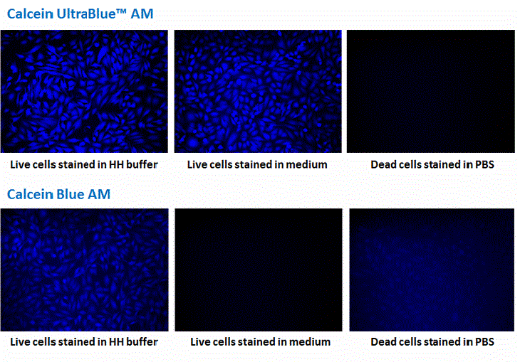 Fluorescence images of HeLa cells