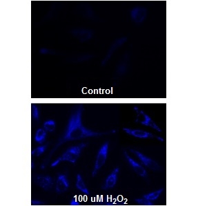 Fluorescence images of intercelluar hydrogen peroxide in HeLa cells