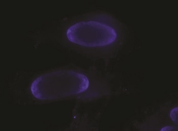 Nuclei stained with Hoechst 33342