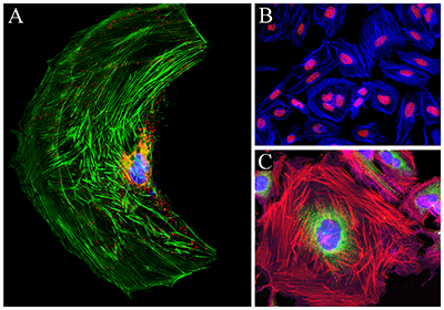 Images of cells stained with Phalloidin