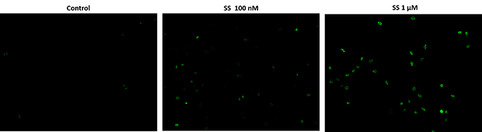 Fluorescence images of TUNEL reaction in HeLa cells.