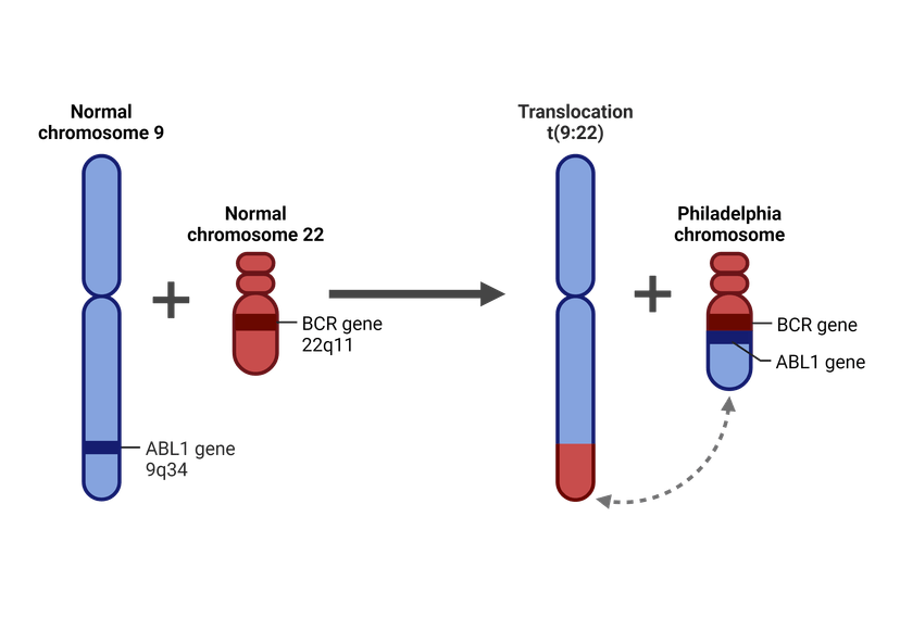 BCR/ABL chromosomal translocation