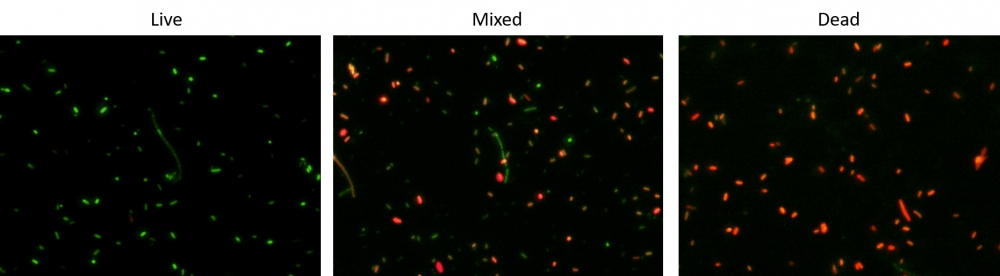 Fluorescence images of E.coli